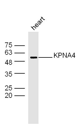 Mouse heart lysates probed with KPNA4 Polyclonal Antibody, Unconjugated (bs-16804R) at 1:300 dilution and 4˚C overnight incubation. Followed by conjugated secondary antibody incubation at 1:10000 for 60 min at 37˚C.