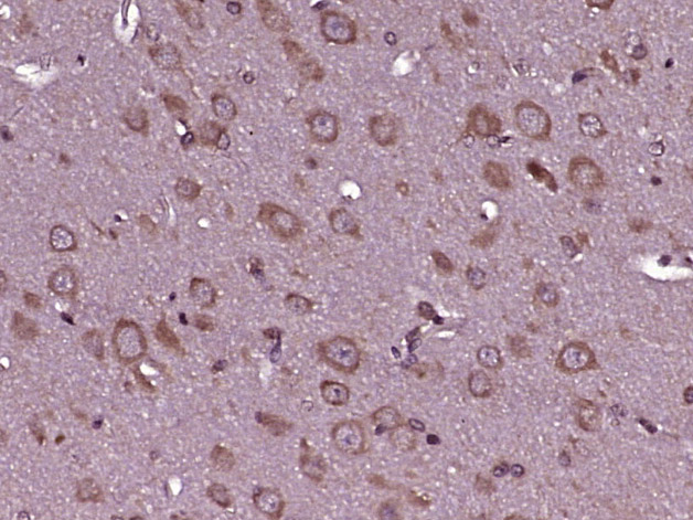 Paraformaldehyde-fixed, paraffin embedded Rat brain; Antigen retrieval by boiling in sodium citrate buffer (pH6.0) for 15min; Block endogenous peroxidase by 3% hydrogen peroxide for 20 minutes; Blocking buffer (normal goat serum) at 37°C for 30min; Antibody incubation with ZFY19 Polyclonal Antibody, Unconjugated (bs-19138R) at 1:400 overnight at 4°C, DAB staining.