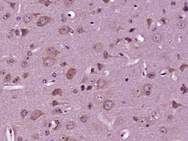 Paraformaldehyde-fixed, paraffin embedded Mouse brain; Antigen retrieval by boiling in sodium citrate buffer (pH6.0) for 15min; Block endogenous peroxidase by 3% hydrogen peroxide for 20 minutes; Blocking buffer (normal goat serum) at 37°C for 30min; Antibody incubation with ZFY19 Polyclonal Antibody, Unconjugated (bs-19138R) at 1:400 overnight at 4°C, DAB staining.