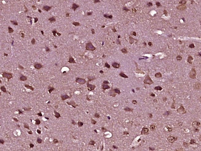 Paraformaldehyde-fixed, paraffin embedded Mouse brain; Antigen retrieval by boiling in sodium citrate buffer (pH6.0) for 15min; Block endogenous peroxidase by 3% hydrogen peroxide for 20 minutes; Blocking buffer (normal goat serum) at 37°C for 30min; Antibody incubation with C9orf65 Polyclonal Antibody, Unconjugated (bs-19448R) at 1:400 overnight at 4°C, DAB staining.