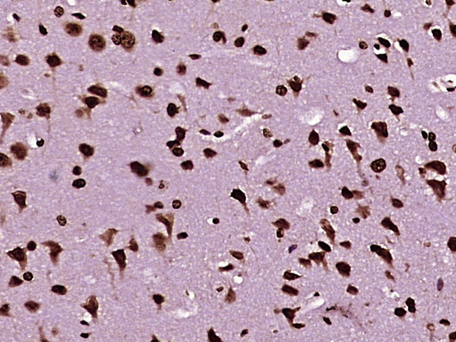 Paraformaldehyde-fixed, paraffin embedded Mouse brain; Antigen retrieval by boiling in sodium citrate buffer (pH6.0) for 15min; Block endogenous peroxidase by 3% hydrogen peroxide for 20 minutes; Blocking buffer (normal goat serum) at 37°C for 30min; Antibody incubation with PSMC3 Polyclonal Antibody, Unconjugated (bs-19463R) at 1:400 overnight at 4°C, DAB staining.