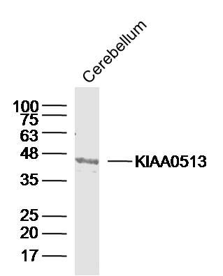 Mouse cerebellum lysates probed with KIAA0513 Polyclonal Antibody, Unconjugated (bs-16975R) at 1:300 dilution and 4˚C overnight incubation. Followed by conjugated secondary antibody incubation at 1:10000 for 60 min at 37˚C.