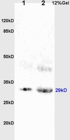 L1 rat brain lysates L2 rat kidney lysates probed with Anti BAMBI Polyclonal Antibody, Unconjugated (bs-12418R) at 1:200 overnight at 4˚C. Followed by conjugation to secondary antibody (bs-0295G-HRP) at 1:3000 for 90 min at 37˚C. Predicted band 29kD. Observed band size:29kD. L1 rat brain lysates L2 rat kidney lysates probed with Anti BAMBI Polyclonal Antibody, Unconjugated (bs-12418R) at 1:200 overnight at 4˚C. Followed by conjugation to secondary antibody (bs-0295G-HRP) at 1:3000 for 90 min at 37˚C. Predicted band 29kD. Observed band size:29kD.