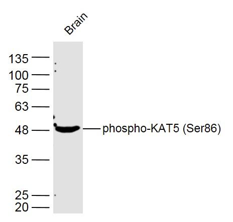 Mouse brain lysates probed with KAT5 (Ser86) Polyclonal Antibody, Unconjugated (bs-17096R) at 1:300 dilution and 4˚C overnight incubation. Followed by conjugated secondary antibody incubation at 1:10000 for 60 min at 37˚C.