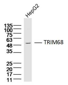 Hepg2 lysates probed with TRIM68 Polyclonal Antibody, Unconjugated (bs-17123R) at 1:300 dilution and 4˚C overnight incubation. Followed by conjugated secondary antibody incubation at 1:10000 for 60 min at 37˚C.