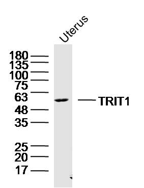 Mouse uterus lysates probed with TRIT1 Polyclonal Antibody, Unconjugated (bs-17134R) at 1:300 dilution and 4˚C overnight incubation. Followed by conjugated secondary antibody incubation at 1:10000 for 60 min at 37˚C.
