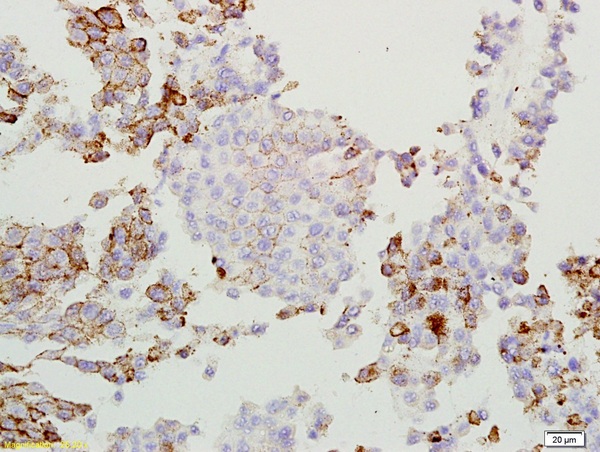 Formalin-fixed and paraffin-embedded rat lung labeled with Anti-GPNMB/Osteoactivin Polyclonal Antibody, Unconjugated (bs-2684R) at 1:200 followed by the conjugated secondary antibody and DAB staining.