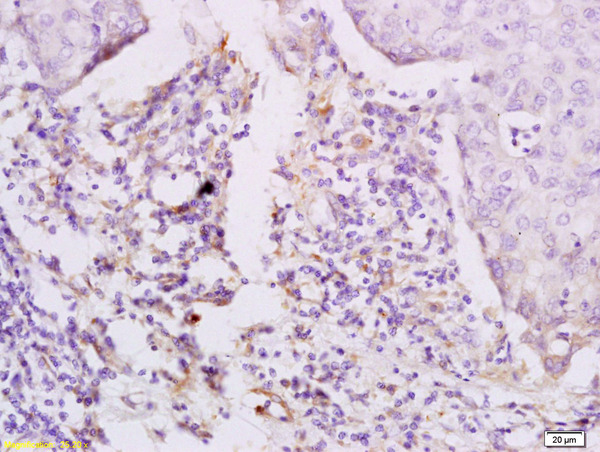 Formalin-fixed and paraffin embedded rat brain labeled with Anti-phospho-MCSF Receptor(Tyr923) Polyclonal Antibody, Unconjugated (bs-3079R) at 1:200 followed by conjugation to the secondary antibody and DAB staining.