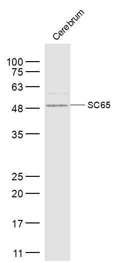 Rat cerebrum lysates probed with SC65 Polyclonal Antibody, Unconjugated (bs-17258R) at 1:300 dilution and 4˚C overnight incubation. Followed by conjugated secondary antibody incubation at 1:10000 for 60 min at 37˚C.