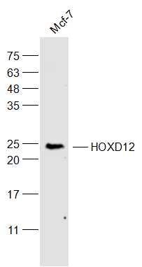 MCF-7 lysates probed with HOXD12 Polyclonal Antibody, Unconjugated (bs-17370R) at 1:300 dilution and 4˚C overnight incubation. Followed by conjugated secondary antibody incubation at 1:10000 for 60 min at 37˚C.