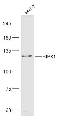 MCF-7 lysates probed with HIPK1 Polyclonal Antibody, Unconjugated (bs-17403R) at 1:300 dilution and 4˚C overnight incubation. Followed by conjugated secondary antibody incubation at 1:10000 for 60 min at 37˚C.