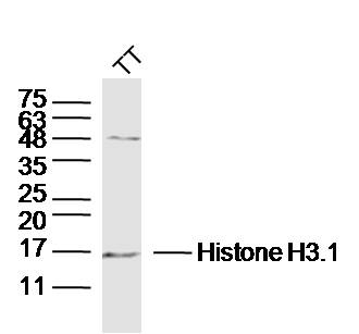 TT lysates probed with Histone H3.1 Polyclonal Antibody, Unconjugated (bs-17422R) at 1:300 dilution and 4˚C overnight incubation. Followed by conjugated secondary antibody incubation at 1:10000 for 60 min at 37˚C.