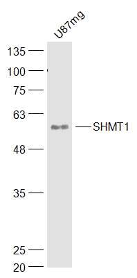 U87MG lysates probed with SHMT1 Polyclonal Antibody, Unconjugated (bs-17468R) at 1:300 dilution and 4˚C overnight incubation. Followed by conjugated secondary antibody incubation at 1:10000 for 60 min at 37˚C.