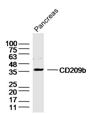 Pancreas lysates probed with DC-SIGNR1/CD209b Polyclonal Antibody, Unconjugated (bs-17488R) at 1:300 dilution and 4˚C overnight incubation. Followed by conjugated secondary antibody incubation at 1:10000 for 60 min at 37˚C.
