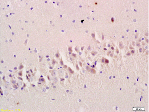 Formalin-fixed and paraffin embedded: rat brain tissue labeled with Anti-PSD-95 Polyclonal Antibody (bs-0179R), Unconjugated at 1:200 followed by conjugation to the secondary antibody and DAB staining