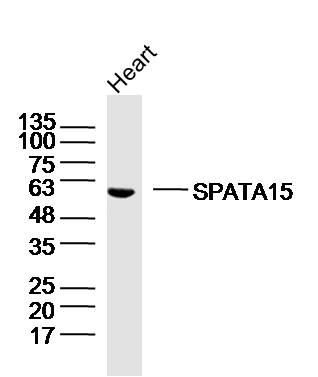 Mouse heart lysates probed with SPATA15/SPATC1 Polyclonal Antibody, Unconjugated (bs-17636R) at 1:300 dilution and 4˚C overnight incubation. Followed by conjugated secondary antibody incubation at 1:10000 for 60 min at 37˚C.