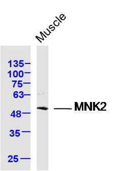 Mouse muscle lysates probed with MNK2 Polyclonal Antibody, Unconjugated (bs-17697R) at 1:300 dilution and 4˚C overnight incubation. Followed by conjugated secondary antibody incubation at 1:10000 for 60 min at 37˚C.