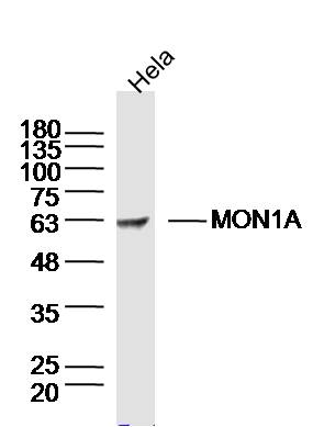 Hela lysates probed with MON1A Polyclonal Antibody, Unconjugated (bs-17711R) at 1:300 dilution and 4˚C overnight incubation. Followed by conjugated secondary antibody incubation at 1:10000 for 60 min at 37˚C. Hela lysates probed with MON1A Polyclonal Antibody, Unconjugated (bs-17711R) at 1:300 dilution and 4˚C overnight incubation. Followed by conjugated secondary antibody incubation at 1:10000 for 60 min at 37˚C.