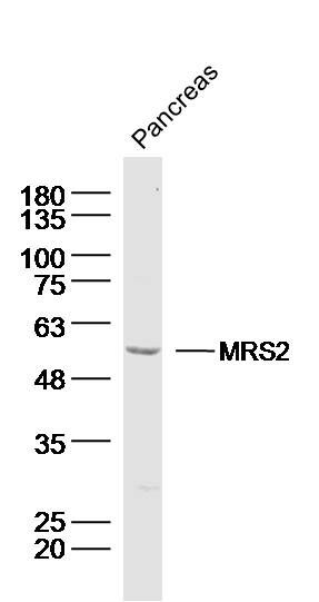 Mouse pancreas lysates probed with MRS2 Polyclonal Antibody, Unconjugated (bs-17836R) at 1:300 dilution and 4˚C overnight incubation. Followed by conjugated secondary antibody incubation at 1:10000 for 60 min at 37˚C.