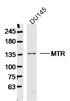 DU145 lysates probed with MTR Polyclonal Antibody, Unconjugated (bs-17892R) at 1:300 dilution and 4˚C overnight incubation. Followed by conjugated secondary antibody incubation at 1:10000 for 60 min at 37˚C.