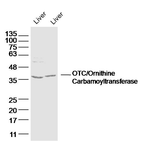 Lane 1: mouse iver lysates; Lane 2: rat liver lysates probed with OTC/Ornithine Carbamoyltransferase Polyclonal Antibody, Unconjugated (bs-18037R) at 1:300 dilution and 4˚C overnight incubation. Followed by conjugated secondary antibody incubation at 1:10000 for 60 min at 37˚C.