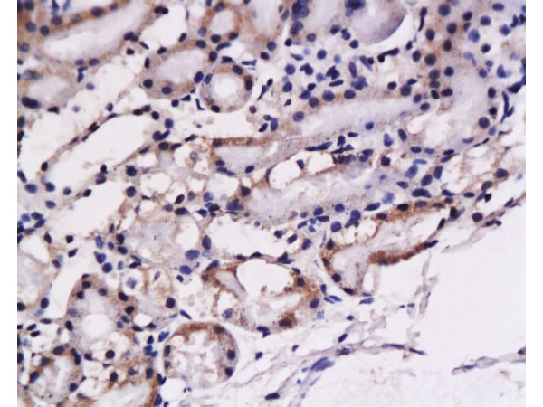 Formalin-fixed and paraffin embedded: rat kidney tissue labeled with Anti-ET-1 Polyclonal Antibody (bs-0188R), Unconjugated at 1:200, followed by conjugation to the secondary antibody and DAB staining