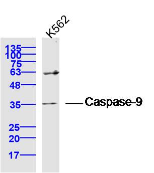 Human K562 lysates probed with caspase 9 Polyclonal Antibody, Unconjugated (bs-20773R) at 1:300 dilution and 4˚C overnight incubation. Followed by conjugated secondary antibody incubation at 1:10000 for 60 min at 37˚C. Human K562 lysates probed with caspase 9 Polyclonal Antibody, Unconjugated (bs-20773R) at 1:300 dilution and 4˚C overnight incubation. Followed by conjugated secondary antibody incubation at 1:10000 for 60 min at 37˚C.