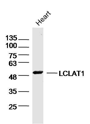 Mouse heart lysates probed with LCLAT1 Polyclonal Antibody, Unconjugated (bs-18190R) at 1:300 dilution and 4˚C overnight incubation. Followed by conjugated secondary antibody incubation at 1:10000 for 60 min at 37˚C.