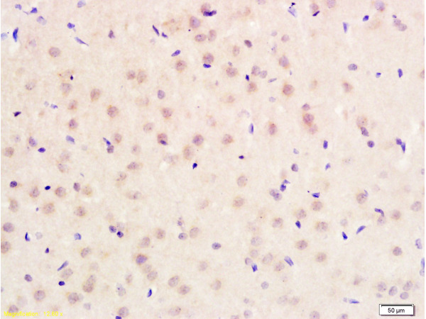 Formalin-fixed and paraffin embedded rat brain tissue labeled with Anti-PITX3 Polyclonal Antibody (bs-2364R), Unconjugated at 1:200 followed by conjugation to the secondary antibody