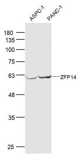 Lane 1: ASPC-1 lysates; Lane 2: PANC-1 lysates probed with ZFP14 Polyclonal Antibody, Unconjugated (bs-18526R) at 1:300 dilution and 4˚C overnight incubation. Followed by conjugated secondary antibody incubation at 1:10000 for 60 min at 37˚C.