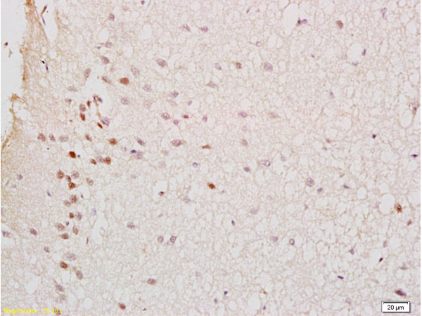 Formalin-fixed and rat brain tissue labeled with Anti-GTPBP10 Polyclonal Antibody (bs-3893R), Unconjugated at 1:200 followed by conjugation to the secondary antibody and DAB staining