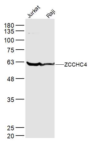 Lane 1: jurkat lysates; Lane 2: raji lysates probed with ZCCHC4 Polyclonal Antibody, Unconjugated (bs-18553R) at 1:300 dilution and 4˚C overnight incubation. Followed by conjugated secondary antibody incubation at 1:10000 for 60 min at 37˚C.