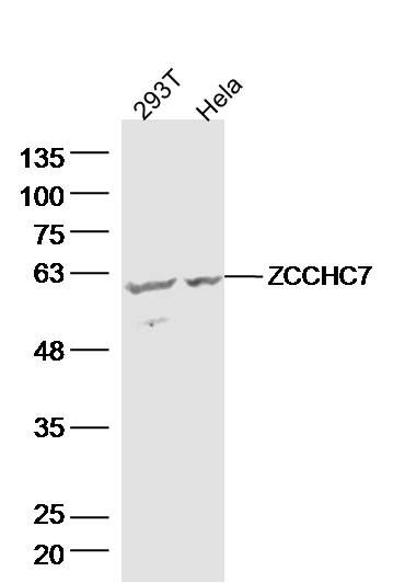 Lane 1: 293T lysates; Lane 2: hela lysates probed with ZCCHC7 Polyclonal Antibody, Unconjugated (bs-18556R) at 1:300 dilution and 4˚C overnight incubation. Followed by conjugated secondary antibody incubation at 1:10000 for 60 min at 37˚C.