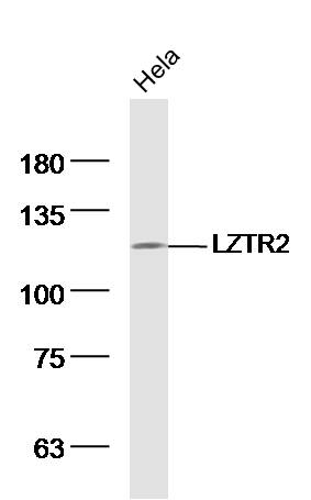Hela lysates probed with LZTR2 Polyclonal Antibody, Unconjugated (bs-18600R) at 1:300 dilution and 4˚C overnight incubation. Followed by conjugated secondary antibody incubation at 1:10000 for 60 min at 37˚C.