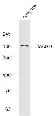 Mouse cerebrum lysates probed with MAGI3 Polyclonal Antibody, Unconjugated (bs-18629R) at 1:300 dilution and 4˚C overnight incubation. Followed by conjugated secondary antibody incubation at 1:10000 for 60 min at 37˚C.