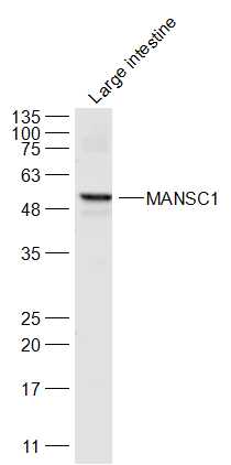 Mouse large intestine lysates probed with MANSC1 Polyclonal Antibody, Unconjugated (bs-18656R) at 1:300 dilution and 4˚C overnight incubation. Followed by conjugated secondary antibody incubation at 1:10000 for 60 min at 37˚C.