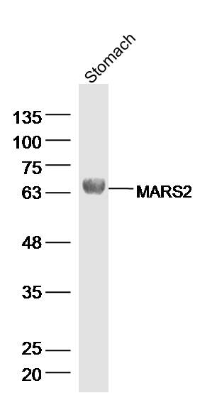 Rat stomach lysates probed with MARS2 Polyclonal Antibody, Unconjugated (bs-18683R) at 1:300 dilution and 4˚C overnight incubation. Followed by conjugated secondary antibody incubation at 1:10000 for 60 min at 37˚C.