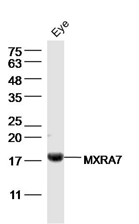 Mouse eye lysates probed with MXRA7 Polyclonal Antibody, Unconjugated (bs-19117R) at 1:300 dilution and 4˚C overnight incubation. Followed by conjugated secondary antibody incubation at 1:10000 for 60 min at 37˚C.