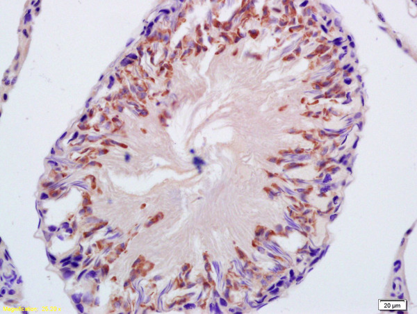Formalin-fixed and paraffin embedded rat testis labeled with Anti-CYP21 Polyclonal Antibody, Unconjugated (bs-2443R) at 1:200, followed by conjugation to the secondary antibody and DAB staining