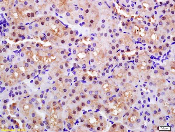 Formalin-fixed and paraffin embedded rat kidney labeled with Anti-PARK7  Polyclonal Antibody, Unconjugated (bs-1306R) at 1:200 followed by conjugation to the secondary antibody and DAB staining.