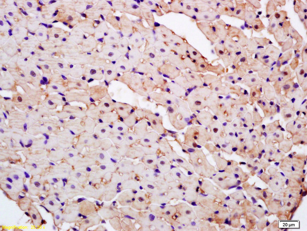 Formalin-fixed and paraffin embedded mouse heart labeled with Anti-PARK7 Polyclonal Antibody, Unconjugated (bs-1306R) at 1:200 followed by conjugation to the secondary antibody and DAB staining.