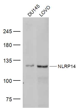 Lane 1: DU145 lysates; Lane 2: LOVO lysates probed with NLRP14 Polyclonal Antibody, Unconjugated (bs-19286R) at 1:300 dilution and 4˚C overnight incubation. Followed by conjugated secondary antibody incubation at 1:10000 for 60 min at 37˚C.