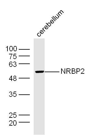 Mouse cerebellum lysates probed with NRBP2 Polyclonal Antibody, Unconjugated (bs-19344R) at 1:300 dilution and 4˚C overnight incubation. Followed by conjugated secondary antibody incubation at 1:10000 for 60 min at 37˚C.