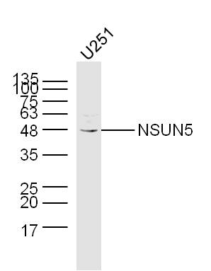 U251 lysates probed with NSUN5 Polyclonal Antibody, Unconjugated (bs-19480R) at 1:300 dilution and 4˚C overnight incubation. Followed by conjugated secondary antibody incubation at 1:10000 for 60 min at 37˚C.