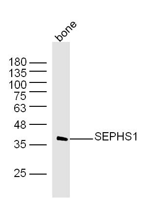 Mouse bone lysates probed with SEPHS1 Polyclonal Antibody, Unconjugated (bs-19627R) at 1:300 dilution and 4˚C overnight incubation. Followed by conjugated secondary antibody incubation at 1:10000 for 60 min at 37˚C.