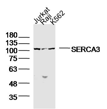 Lane1: jurkat; Lane 2: raji; Lane 3: K562 lysates probed with SERCA3 Polyclonal Antibody, Unconjugated (bs-19653R) at 1:300 dilution and 4˚C overnight incubation. Followed by conjugated secondary antibody incubation at 1:10000 for 60 min at 37˚C.