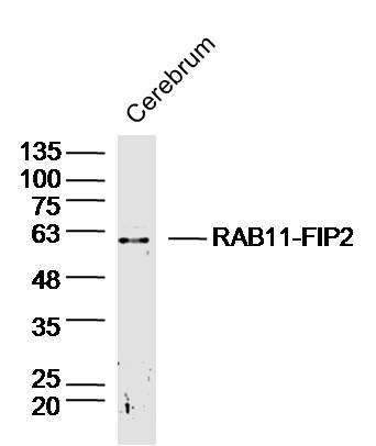 Mouse cerebrum lysates probed with RAB11-FIP2 Polyclonal Antibody, Unconjugated (bs-19705R) at 1:300 dilution and 4˚C overnight incubation. Followed by conjugated secondary antibody incubation at 1:10000 for 60 min at 37˚C.