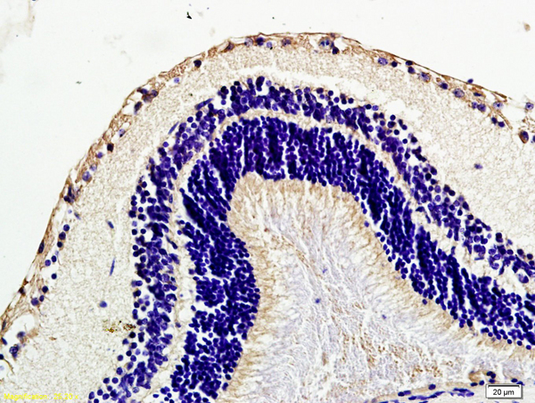 Formalin-fixed and paraffin embedded mouse eye labeled with Anti Caveolin-1 Polyclonal Antibody, Unconjugated (bs-1453R) at 1:200 followed by conjugation to the secondary antibody and DAB staining.