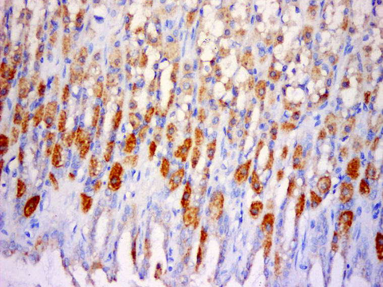 Paraformaldehyde-fixed, paraffin embedded Rat stomach; Antigen retrieval by boiling in sodium citrate buffer (pH6.0) for 15min; Block endogenous peroxidase by 3% hydrogen peroxide for 20 minutes; Blocking buffer (normal goat serum) at 37°C for 30min; Antibody incubation with SLC25A38 Polyclonal Antibody, Unconjugated (bs-19815R) at 1:500 overnight at 4°C, DAB staining.