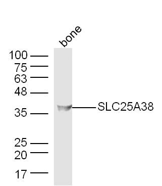 Mouse bone lysates probed with SLC25A38 Polyclonal Antibody, Unconjugated (bs-19815R) at 1:300 dilution and 4˚C overnight incubation. Followed by conjugated secondary antibody incubation at 1:10000 for 60 min at 37˚C. Mouse bone lysates probed with SLC25A38 Polyclonal Antibody, Unconjugated (bs-19815R) at 1:300 dilution and 4˚C overnight incubation. Followed by conjugated secondary antibody incubation at 1:10000 for 60 min at 37˚C.